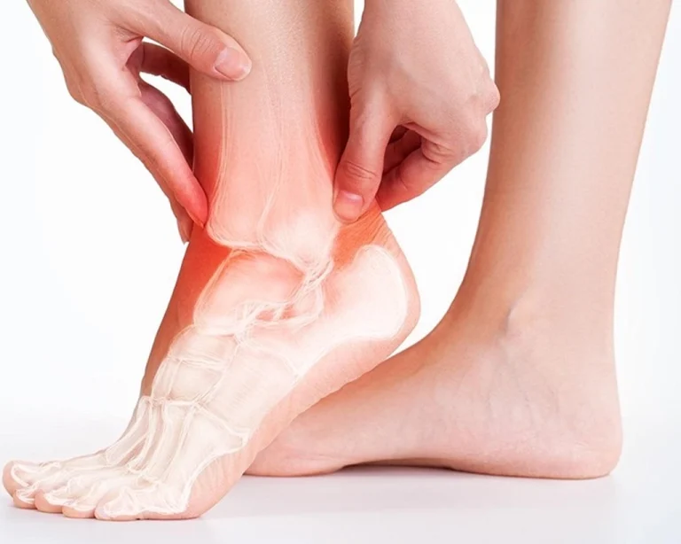 Tekrarlayan Bilek Burkulması Nedir, Neden Olur?